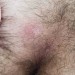 pnpbottom