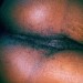 Eatmeup