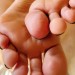 Tonytoes